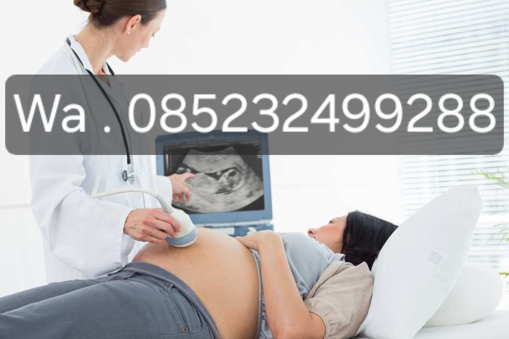 pusat obat aborsi singapura 085232499288 jual obat cytotec di singapura